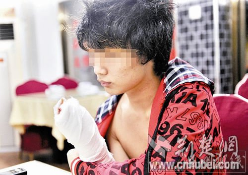 醫院因打工仔付不起醫藥費將已縫好傷口拆線