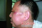 司法局長會議上暴打副局長 司法局正副局長互毆好像