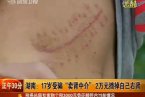 常州搗毀圈養賣腎者窩點 抓獲圈養賣腎者犯罪嫌疑人