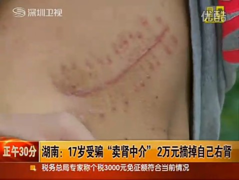 搗毀圈養(yǎng)賣腎者窩點
