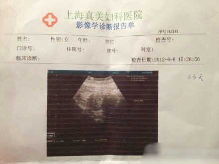 袁立懷孕