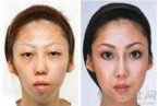 中國男子馮健狀告老婆太丑獲賠75萬元 原因是老婆太