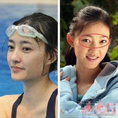 王麗坤整容照片疑割雙眼皮她本人不承認