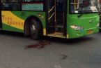 女子被公交車碾斷腿 溫州永嘉公交車將一名女子撞傷