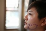 王梓整容前后對比 微博直播整容過程