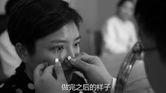 王梓整容前后對比 微博直播整容過程