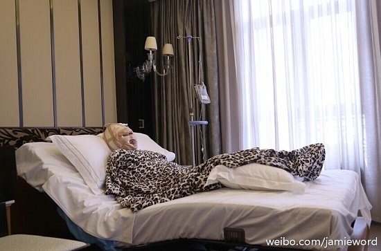 王梓整容前后對比 微博直播整容過程