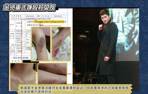 金賢重毆打女友a某致其骨折