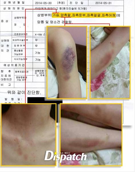金賢重女友受虐照片