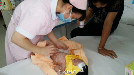 兔唇男嬰被棄荒野