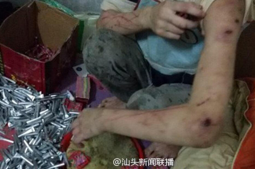 姐弟遭虐打不敢報警