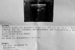 宿州1歲男童被診懷孕 醫(yī)院犯低級(jí)錯(cuò)誤