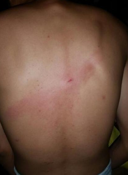 河北教官打傷高中生:手持鋼管 20人被打至鼻青臉腫