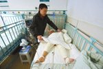 可憐3歲女童掉進開水深度燙傷 家里有小孩把開水鍋