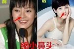 孫儷自曝整過(guò)容 孫儷做客《非常靜距離》自曝整過(guò)容