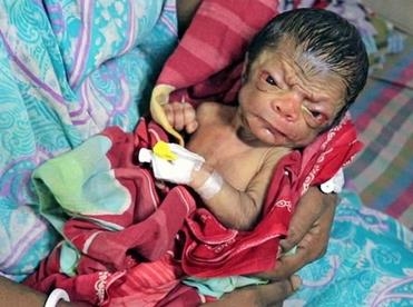 新生兒容貌似80歲