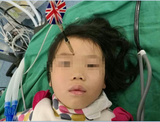 玩飛鏢扎妹妹眉心