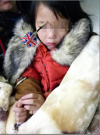 玩飛鏢扎妹妹眉心