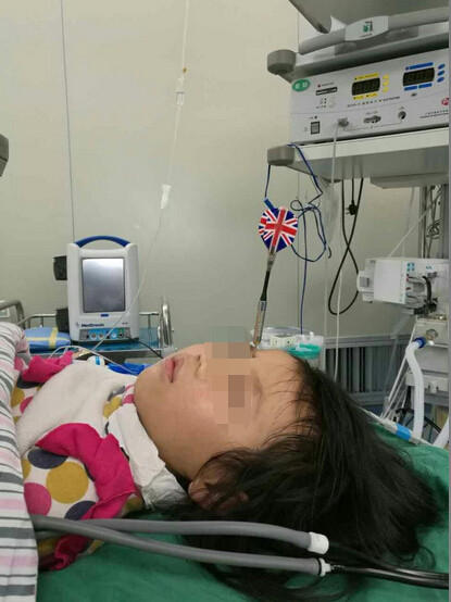玩飛鏢扎妹妹眉心