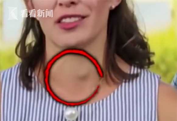 看電視發(fā)現(xiàn)患腫瘤