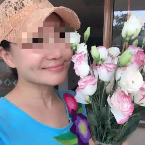 60歲老賴整成少女，頸部的皺紋暴露了老年的秘密