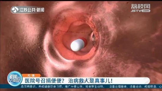 無錫一醫院號召捐獻糞便救人