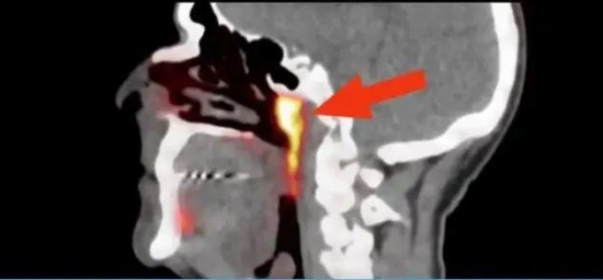 科學家在人體內發現未知新器官