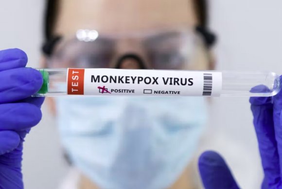 美國可能需要近70億美元來抗擊猴痘疫情